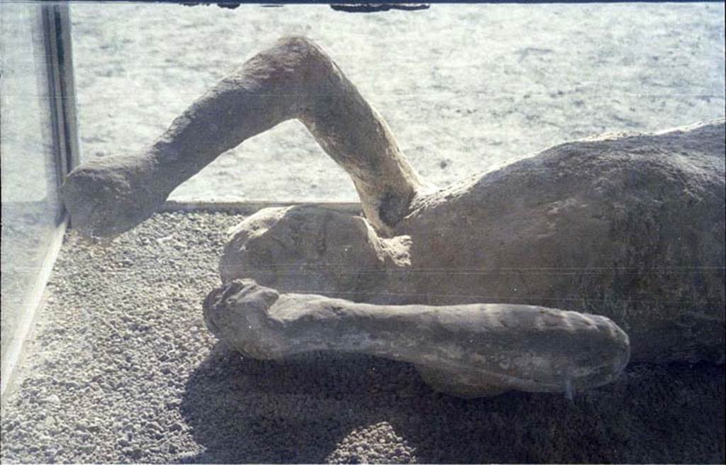 Victim 14. July 2011. 
Detail of head and upper body of plaster cast of victim 14 photographed on display in north-west corner of Macellum, but found near Stabian Gate.
Photo courtesy of Rick Bauer.

