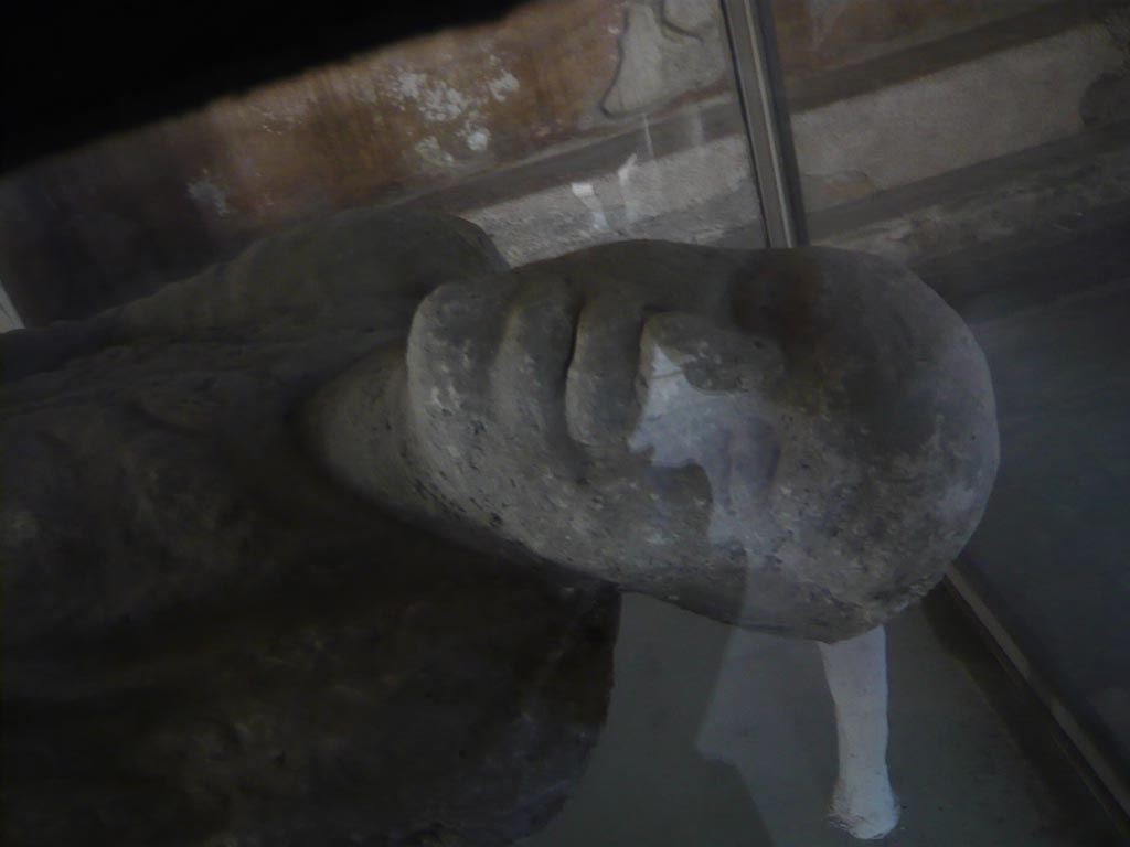 VII.1.8 Pompeii. May 2012. Victim 15. Detail of head of plaster cast of body, in men’s changing room 2. 
Photo courtesy of Buzz Ferebee.
